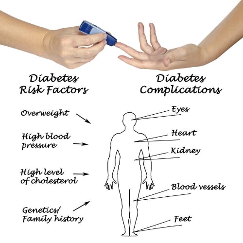 illustration of diabetes risk factors and complications