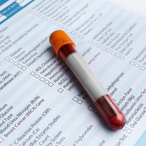 a diagnostic blood test kit with form and vial container for fluids