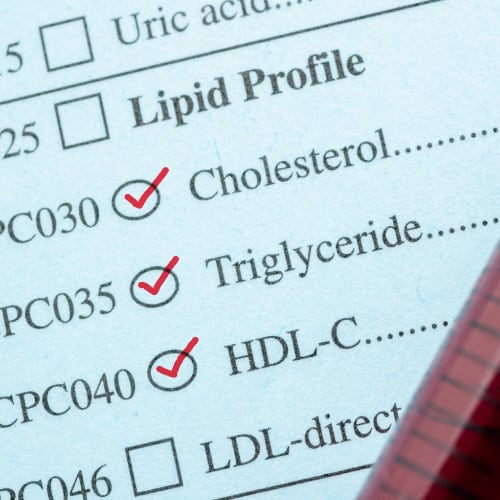 lipid profile panel measuring cholesterol, triglyceride, hdl-c