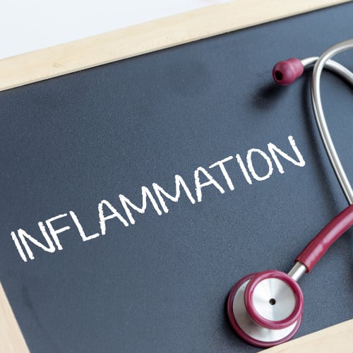 the word inflammation spelled out on a chalkboard with a stethescope