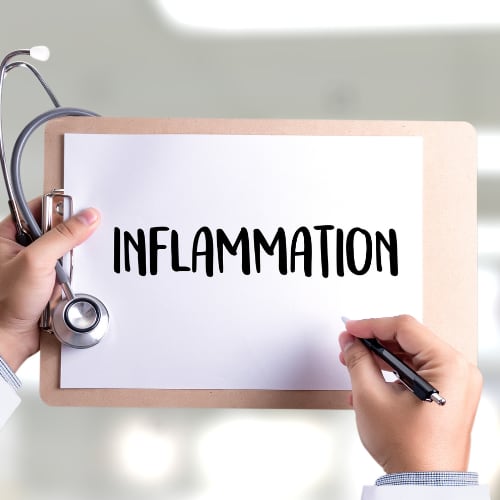 medical provider holding a clipboard that reads inflammation