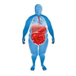 Illustration of inflammation in the gut for an obese woman.