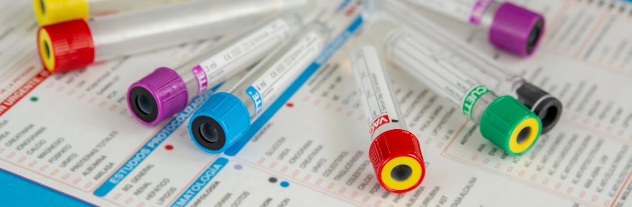 diagnostic testing kit including vials and lab form to document types of tests