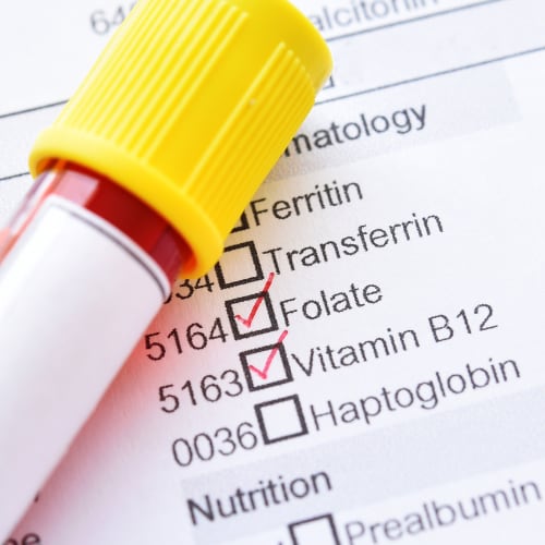 blood test for vitamin b12 and folate