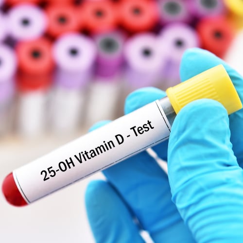 vitamin D blood test