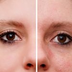 woman's face illustrating good and bad skin
